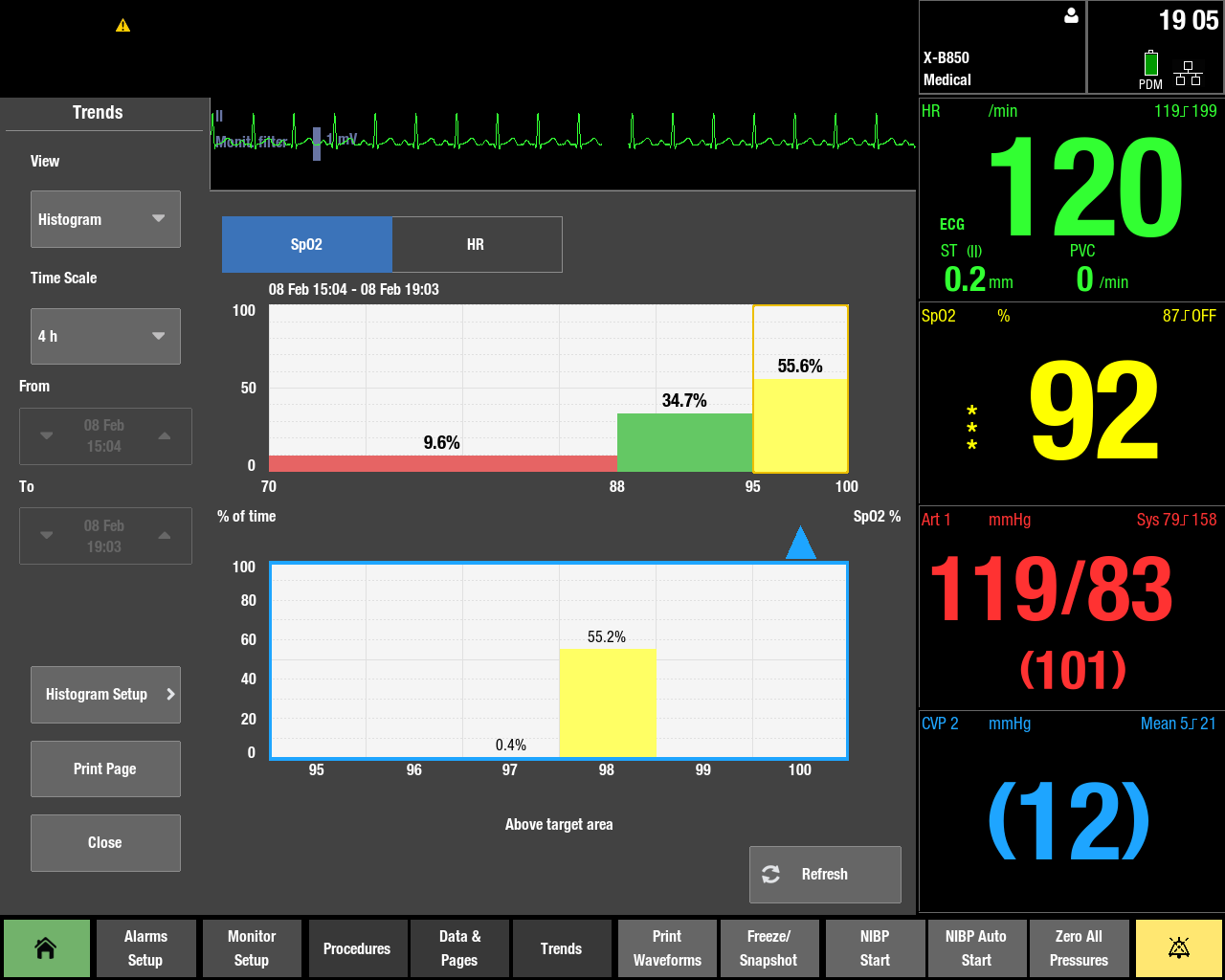 CARESCAPE B450 | Patient Monitoring | GE Healthcare