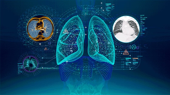 Future Of X-ray | Beyond Imaging | GE Healthcare | GE Healthcare