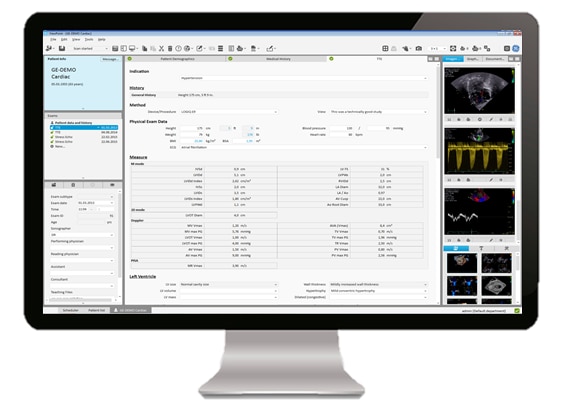 ViewPoint 6 and EchoPAC Suite for Cardiology - Ultrasound IT ...