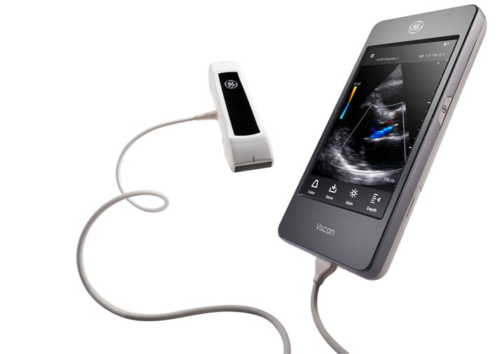 Vscan Extend Portable Ultrasound | GE HealthCare (United States)