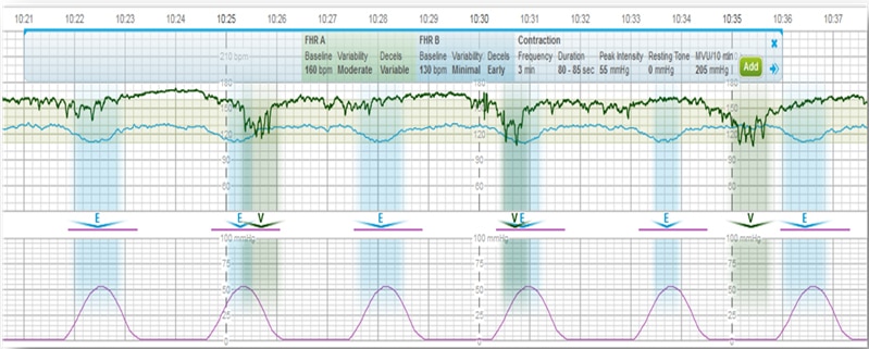 Centricity Perinatal Software | GE Healthcare