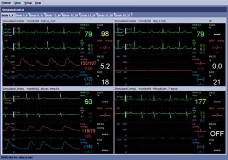 Alarm Management | GE Healthcare