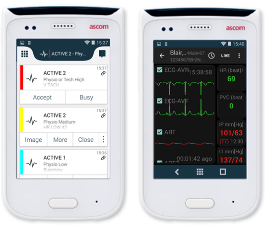 GE Ascom Secondary Alarm Notification Solution | GE Healthcare