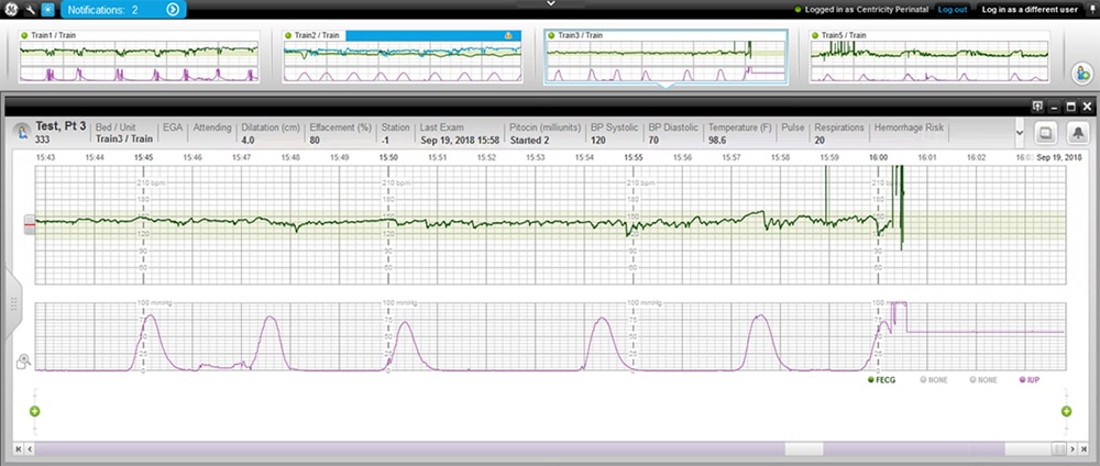 Centricity Perinatal Software | GE Healthcare