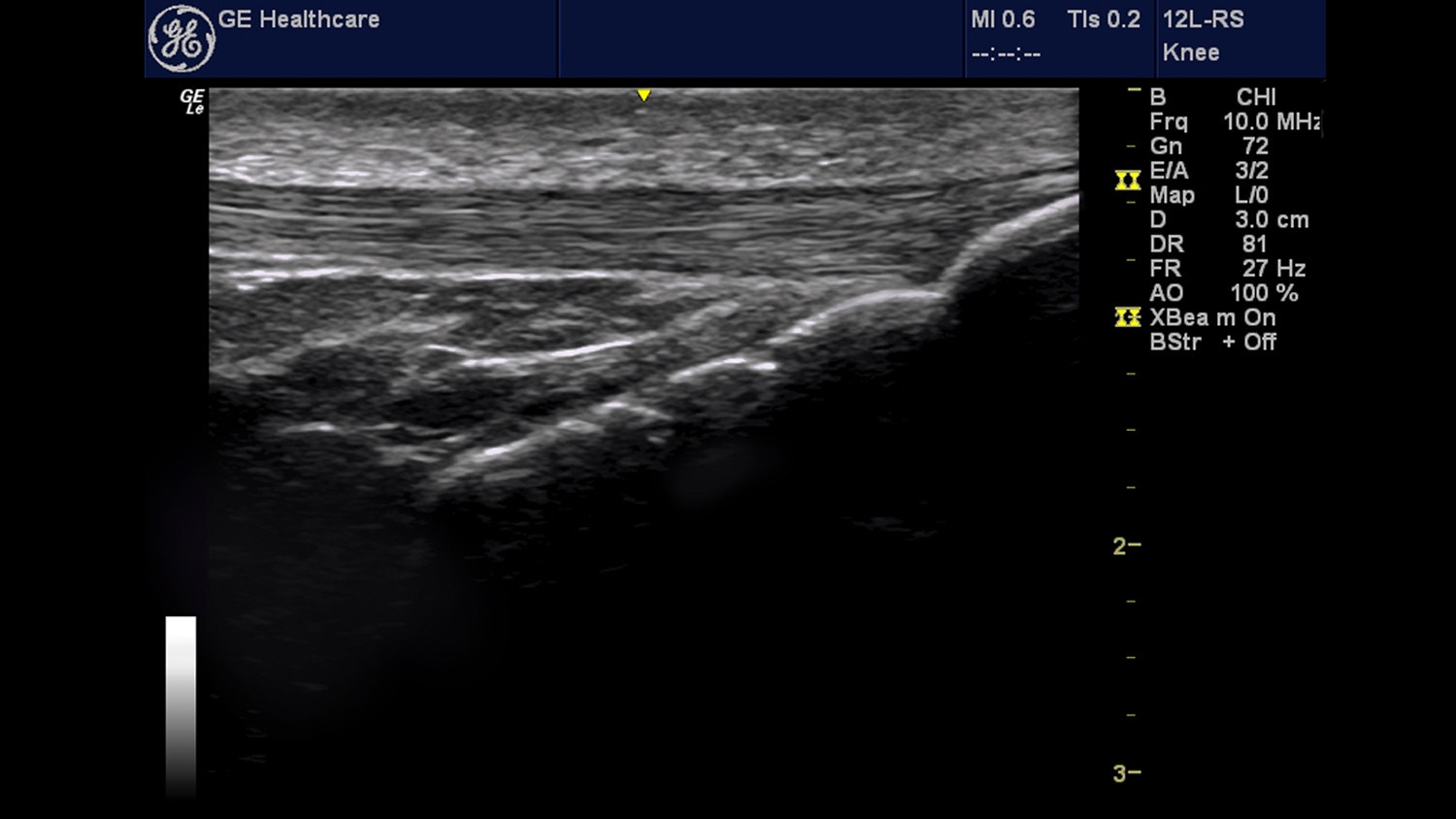 Musculoskeletal (MSK) | GE Healthcare