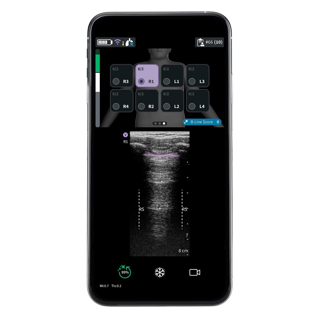 Vscan Air™ CL Vscan Air™ CL