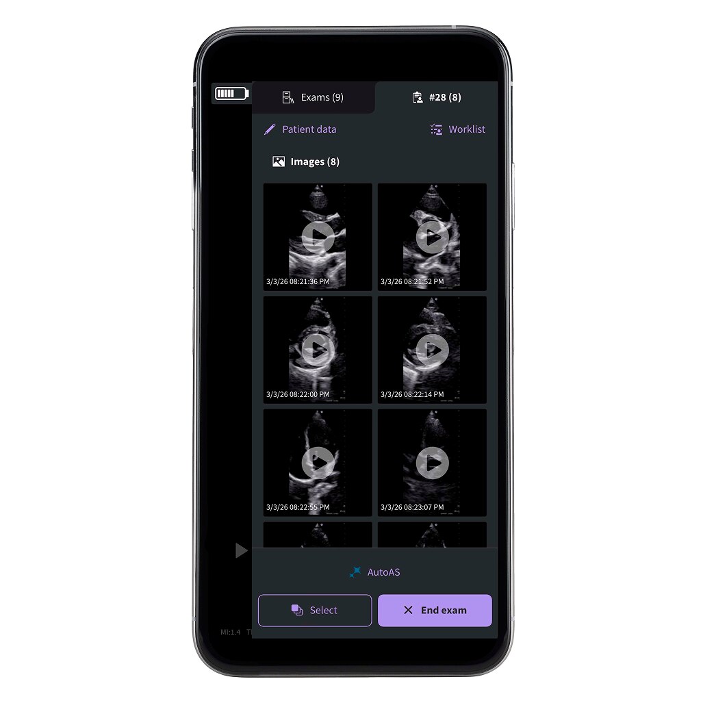 Vscan Air™ SL