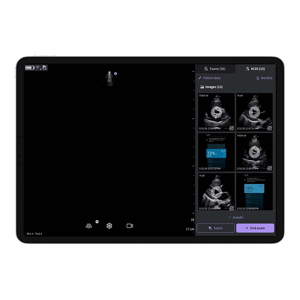 Vscan Air™ SL