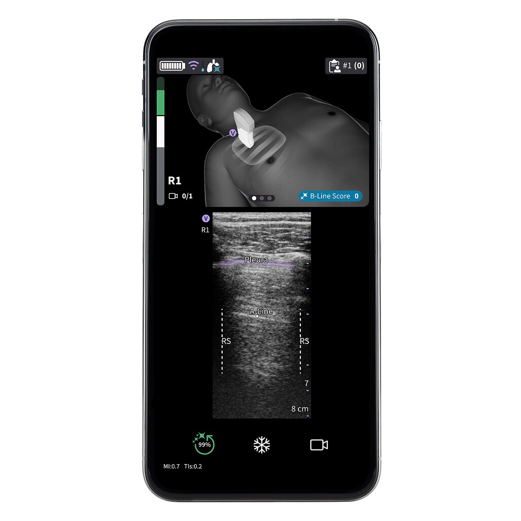 Vscan Air™ Premier Innovations Subscription