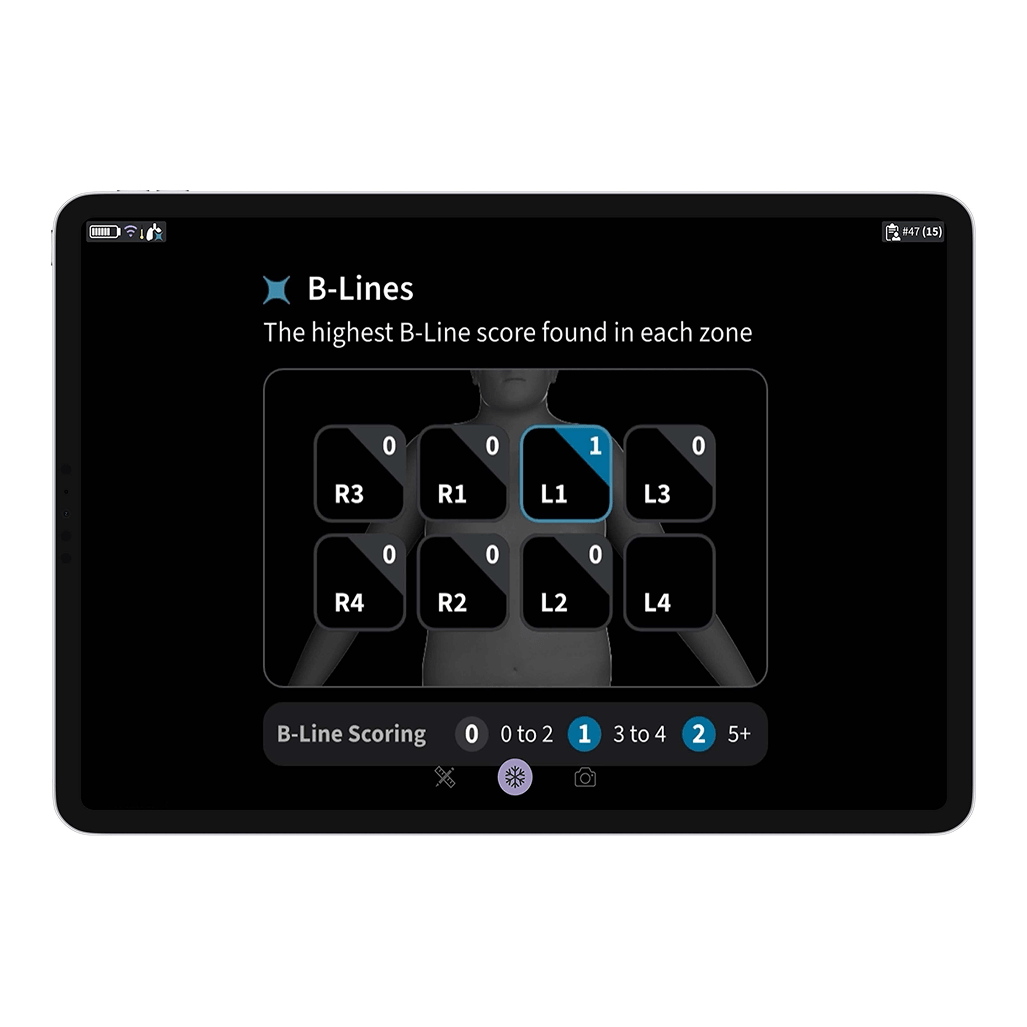 Vscan Air™ Premier Innovations Subscription