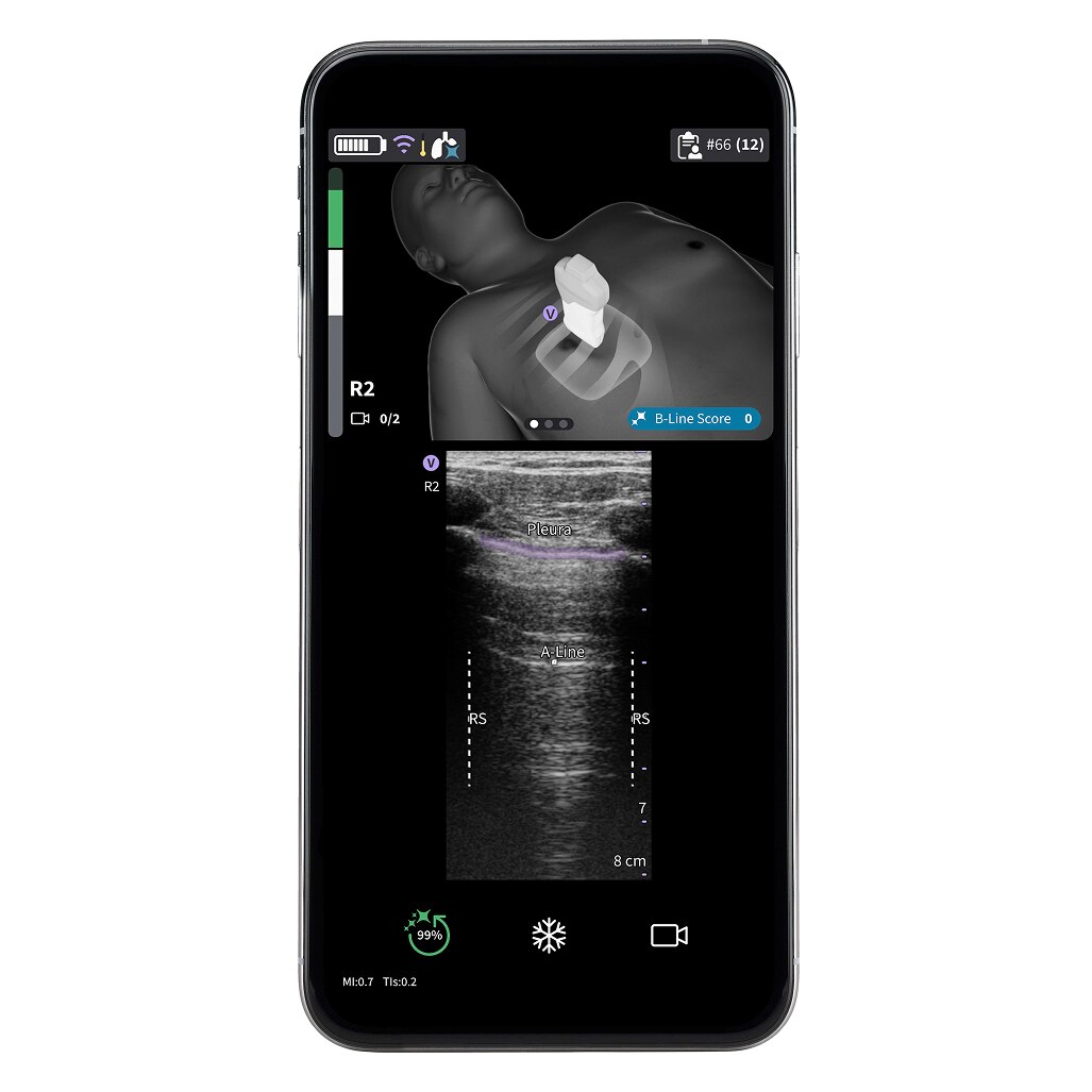 Vscan Air™ Premier Innovations Subscription