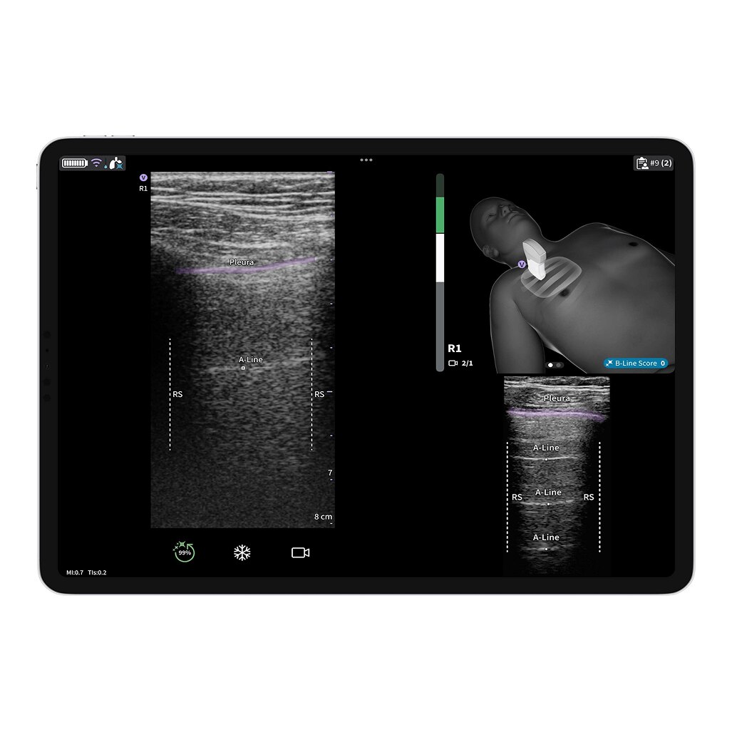 Vscan Air™ CL Vscan Air™ CL