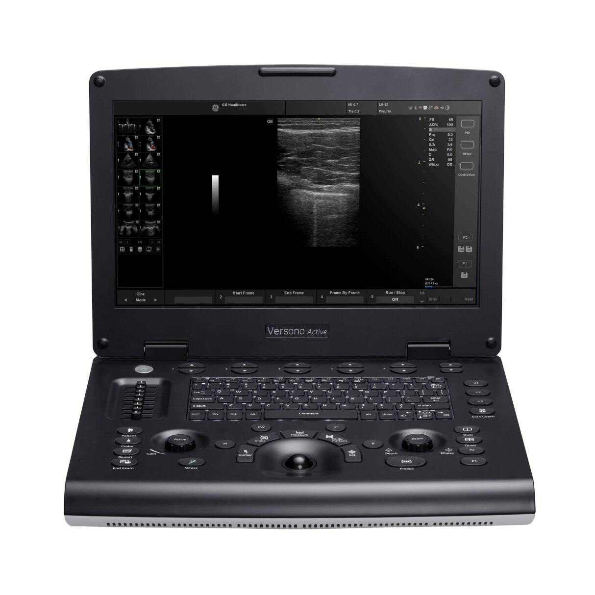Versana Active™ Versana Active™