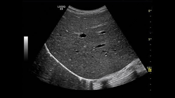 hotspot tours-logiq e9-coded-harmonic-imaging_jpg